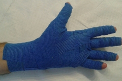 bendaggio compressione graduale2
