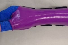tutore-combinato-con-bendaggio-compressivo1